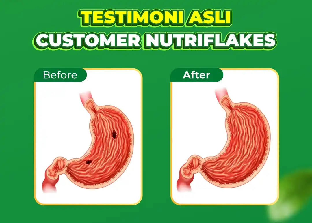 Nutriflakes